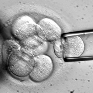 stem cell
